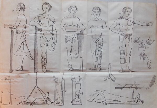 MAYOR (Matthias) Nouveau système de déligation chirurgicale, ou Exposé de moyens simples et faciles de remplacer avec avantage les bandes et la charpie; de traiter les fractures sans attelles et sans obliger les blessés de garder le lit; de redresser les gibbosités sans lits mécaniques; de soulever les malades sans douleurs ni embarras; de mettre le traitement d'un grand nombre d'affections chirurgicales graves à la portée des masses, en l'absence des hommes de l'art, et de populariser la chirurgie dans les armées. [suivi de] Fragmens de chirurgie populaire. Paris, Genève & Lausanne, Cherbulier & Doy, 1832-1831. – Image 4