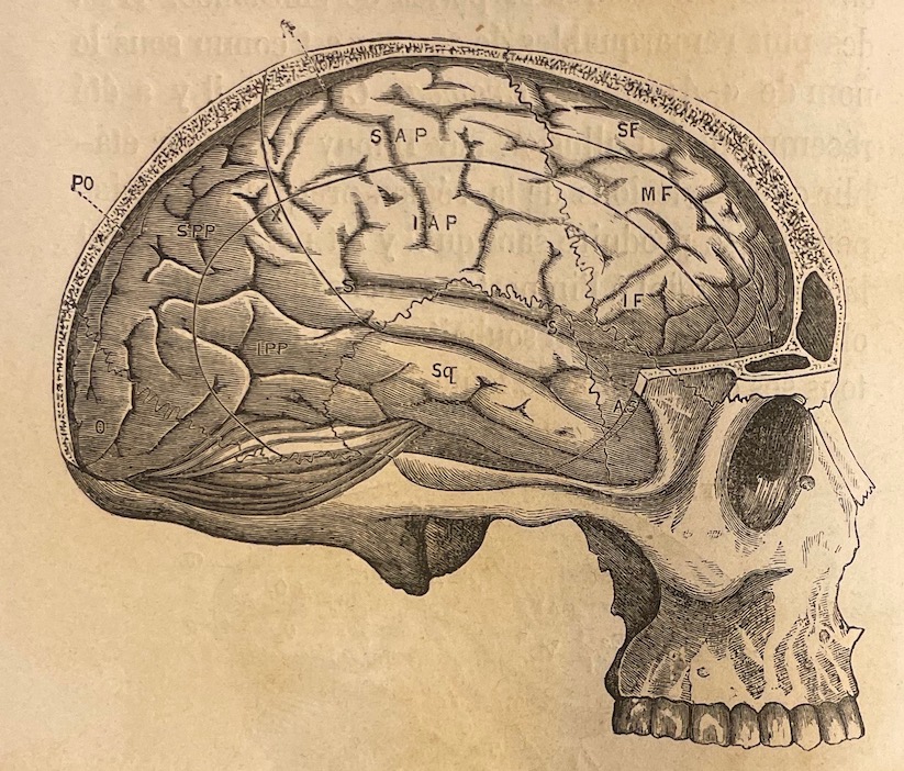 FERRIER (David) De la localisation des maladies cérébrales, suivi d'un mémoire sur les Localisations motrices dans l'écorce des hémisphères du cerveau, par MM. J. M. Charcot et A. Pitres. Paris, Librairie Germer Baillière et Cie, 1879. – Image 3