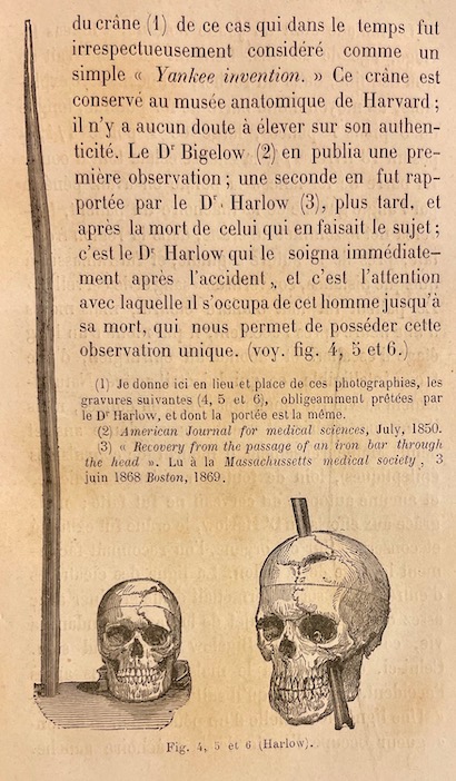 FERRIER (David) De la localisation des maladies cérébrales, suivi d'un mémoire sur les Localisations motrices dans l'écorce des hémisphères du cerveau, par MM. J. M. Charcot et A. Pitres. Paris, Librairie Germer Baillière et Cie, 1879. – Image 4