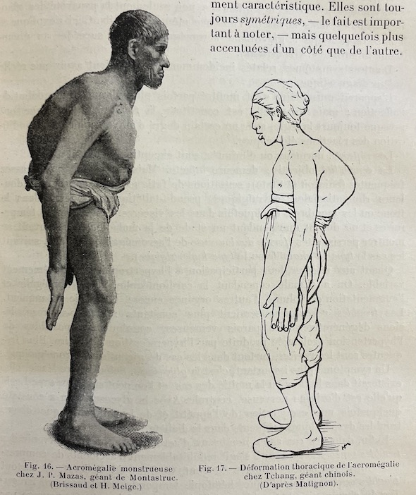 BRISSAUD - PINARD - RECLUS Nouvelle pratique médico-chirurgicale illustrée. Tome I à VIII. Paris, Masson & Cie, 1911. – Image 3