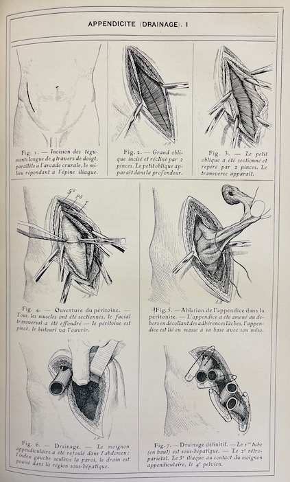 BRISSAUD - PINARD - RECLUS Nouvelle pratique médico-chirurgicale illustrée. Tome I à VIII. Paris, Masson & Cie, 1911. – Image 4